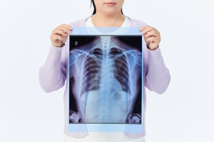 4根肋骨骨折属于几级伤残最新